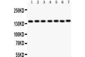 Image no. 1 for anti-Poly (ADP-Ribose) Polymerase 1 (PARP1) (AA 670-858) antibody (ABIN3043378)