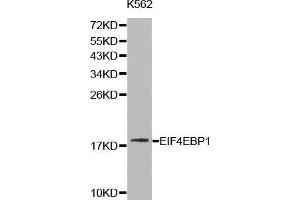 Image no. 1 for anti-Eukaryotic Translation Initiation Factor 4E Binding Protein 1 (EIF4EBP1) antibody (ABIN3021844)