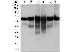 Image no. 6 for anti-Keratin 5 (KRT5) antibody (ABIN969508)