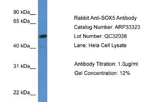 anti-SRY (Sex Determining Region Y)-Box 5 (SOX5) (C-Term) antibody