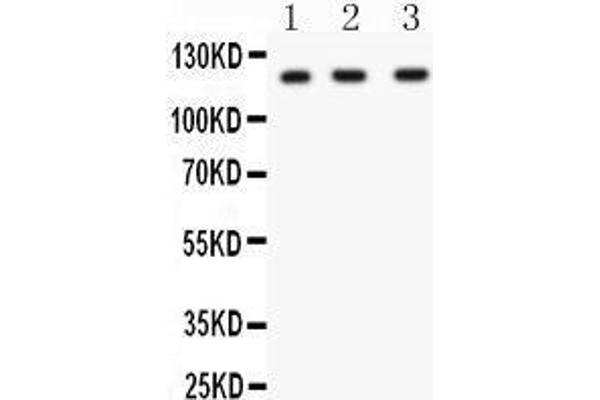 anti-Hypoxia Inducible Factor 1, alpha Subunit (Basic Helix-Loop-Helix Transcription Factor) (HIF1A) (AA 703-732), (C-Term) antibody
