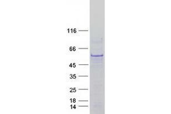 p53 Protein (Transcript Variant 1) (Myc-DYKDDDDK Tag)