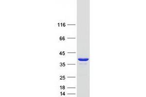 Image no. 1 for Pyrophosphatase (Inorganic) 1 (PPA1) protein (Myc-DYKDDDDK Tag) (ABIN2730233)