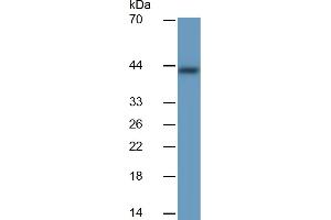 Rabbit Detection antibody from the kit in WB with Positive Control:  Sample Human Stomach lysate.