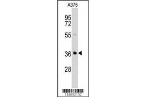 Image no. 2 for anti-Aldo-Keto Reductase Family 1, Member B1 (Aldose Reductase) (AKR1B1) (AA 290-316), (C-Term) antibody (ABIN389205)