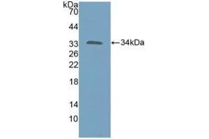 KATNA1 antibody  (AA 8-229)