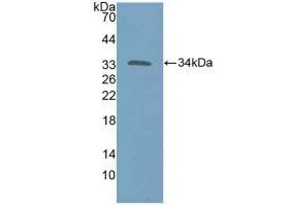 KATNA1 antibody  (AA 8-229)