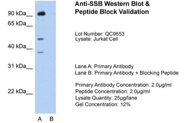 anti-Sjogren Syndrome Antigen B (SSB) (N-Term) antibody