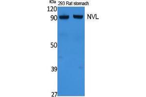 Image no. 1 for anti-Nuclear VCP-Like (NVL) (Internal Region) antibody (ABIN3187615)