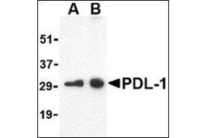 Image no. 3 for anti-CD274 (PD-L1) (Center) antibody (ABIN500467)