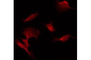 Image no. 1 for anti-Solute Carrier Family 22 Member 18 (SLC22A18) (C-Term) antibody (ABIN6258498)
