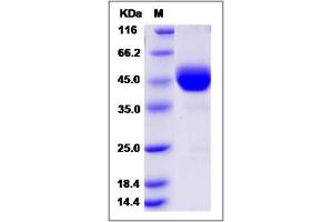 Image no. 1 for Activin A Receptor Type II-Like 1 (ACVRL1) (AA 1-119) (Active) protein (Fc Tag) (ABIN2008896)