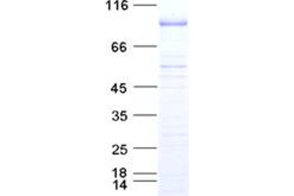 p300 Protein (DYKDDDDK Tag)