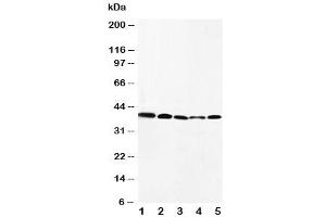 Image no. 2 for anti-Chemokine (C-C Motif) Receptor 10 (CCR10) (AA 312-327) antibody (ABIN3030490)