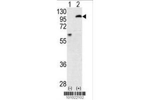 Image no. 2 for anti-Protein Kinase C, epsilon (PRKCE) (AA 206-236), (N-Term) antibody (ABIN391007)