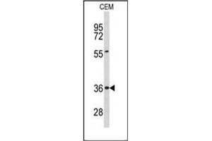 Image no. 2 for anti-Peroxisomal Biogenesis Factor 16 (PEX16) (AA 254-283), (Middle Region) antibody (ABIN954098)