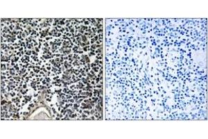 Image no. 1 for anti-ATP-Binding Cassette, Sub-Family B (MDR/TAP), Member 7 (ABCB7) (AA 691-740) antibody (ABIN1534672)