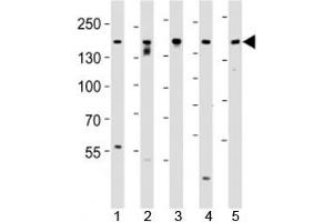 Image no. 5 for anti-Tuberous Sclerosis 2 (TSC2) (AA 1776-1805) antibody (ABIN3029331)