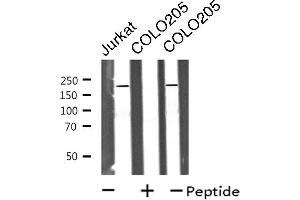 Image no. 1 for anti-CDC42 Binding Protein Kinase alpha (DMPK-Like) (CDC42BPA) (Internal Region) antibody (ABIN6258012)