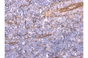 IHC-P Image TNFalpha-IP 2 antibody [C1C3] detects TNFalpha-IP 2 protein at cytosol on mouse spleen by immunohistochemical analysis.