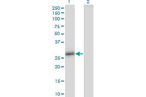 Western Blot analysis of CLDN16 expression in transfected 293T cell line by CLDN16 monoclonal antibody (M02), clone 1F2.