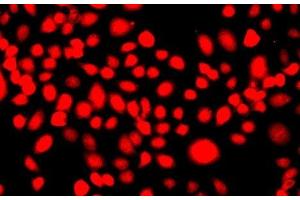 Immunofluorescence analysis of A549 cells using IFRD1 Polyclonal Antibody