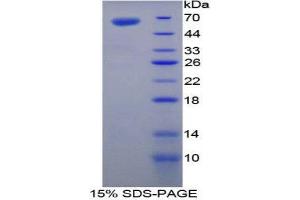 Image no. 1 for Transglutaminase 1, Keratinocyte (TGM1) (AA 337-607) protein (His tag,GST tag) (ABIN1879483)
