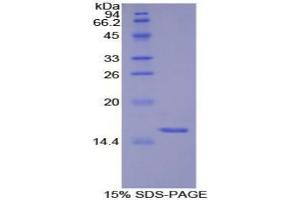 Image no. 1 for S100 Protein (S100) protein (ABIN3011531)
