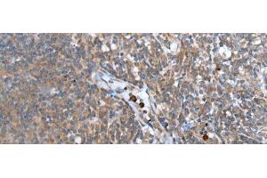 Immunohistochemistry of paraffin-embedded Human tonsil tissue using WISP2 Polyclonal Antibody at dilution of 1:45(x200)
