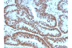 Image no. 4 for anti-BMI1 Polycomb Ring Finger Oncogene (BMI1) (AA 142-326) antibody (ABIN6940582)