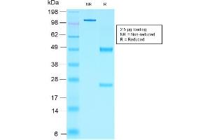 Image no. 1 for anti-NK2 Homeobox 2 (Nkx2-2) (AA 1-119) antibody (ABIN6940204)