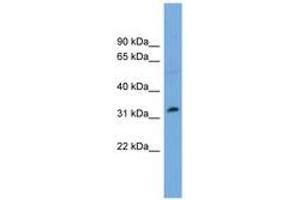 Image no. 1 for anti-PHD Finger Protein 13 (PHF13) (AA 179-228) antibody (ABIN6744908)