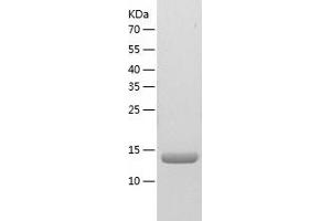NME2 Protein (AA 1-152) (His tag)