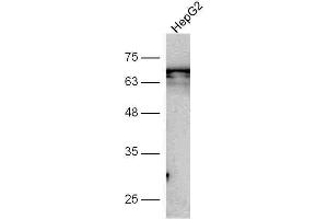 Image no. 3 for anti-Gasdermin A (GSDMA) (AA 21-120) antibody (ABIN2559502)