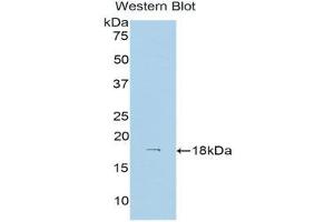 Image no. 1 for anti-Hexokinase 1 (HK1) (AA 137-270) antibody (ABIN1173547)