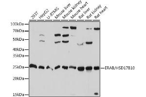 Western blot analysis of extracts of various cell lines, using ERAB/HSD17B10 Rabbit mAb (ABIN1513420, ABIN3021162, ABIN3021163 and ABIN7101350) at 1:1000 dilution.
