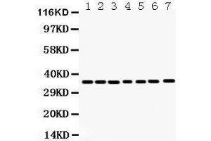 Image no. 5 for anti-Annexin A3 (ANXA3) (AA 153-184), (Middle Region) antibody (ABIN3043501)
