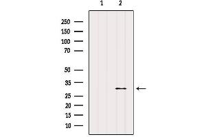 Image no. 1 for anti-E2F Transcription Factor 6 (E2F6) antibody (ABIN6261413)