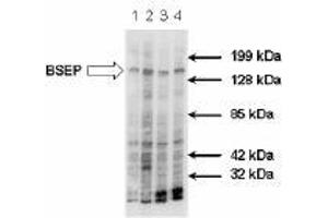 Image no. 1 for anti-ATP-Binding Cassette, Sub-Family B (MDR/TAP), Member 11 (ABCB11) antibody (ABIN187437)