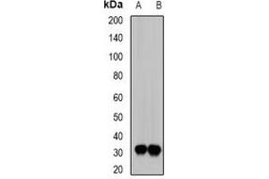 Image no. 2 for anti-E3 Ubiquitin-Protein Ligase SIAH1 (SIAH1) antibody (ABIN2967034)