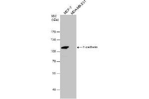 Image no. 4 for anti-Cadherin 1, Type 1, E-Cadherin (Epithelial) (CDH1) (Center) antibody (ABIN2854751)