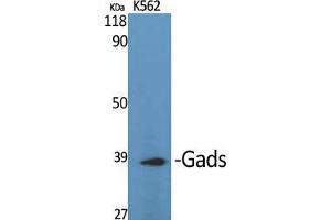 Image no. 2 for anti-GRB2-Related Adaptor Protein 2 (GRAP2) (Internal Region) antibody (ABIN3184727)