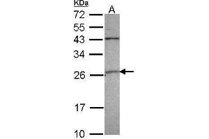 Image no. 2 for anti-Glutathione S-Transferase alpha 4 (GSTA4) (Center) antibody (ABIN2855818)