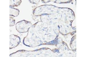 Immunohistochemistry of paraffin-embedded Human placenta using CLUH Polyclonal Antibody at dilution of 1:100 (40x lens).