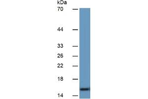 Image no. 5 for Carcinoembryonic Antigen Gene Family (CEA) ELISA Kit (ABIN6730922)