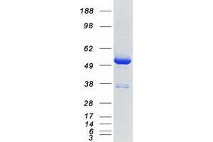 Image no. 1 for DEAD (Asp-Glu-Ala-Asp) Box Polypeptide 39B (DDX39B) (Transcript Variant 1) protein (Myc-DYKDDDDK Tag) (ABIN2715155)