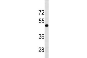 Image no. 1 for anti-Transforming Growth Factor, beta Receptor 1 (TGFBR1) (AA 145-172) antibody (ABIN3029223)