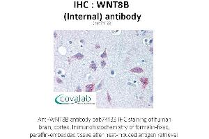 Image no. 2 for anti-Wingless-Type MMTV Integration Site Family, Member 8B (WNT8B) (Internal Region) antibody (ABIN1740842)