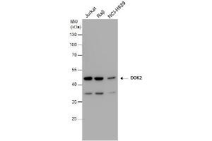 WB Image DOK2 antibody detects DOK2 protein by western blot analysis.