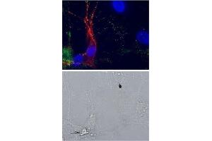 Multiplex staining of p75NTR and mGluR1 in rat DRGs - Cell surface detection of p75NTR and mGluR1 in intact live DRG neurons labeled with Anti-mGluR1 (extracellular) Antibody (ABIN7043245, ABIN7044330 and ABIN7044331), (1:100) followed by goat-anti-rabbit-AlexaFluor-488 secondary antibody (green).